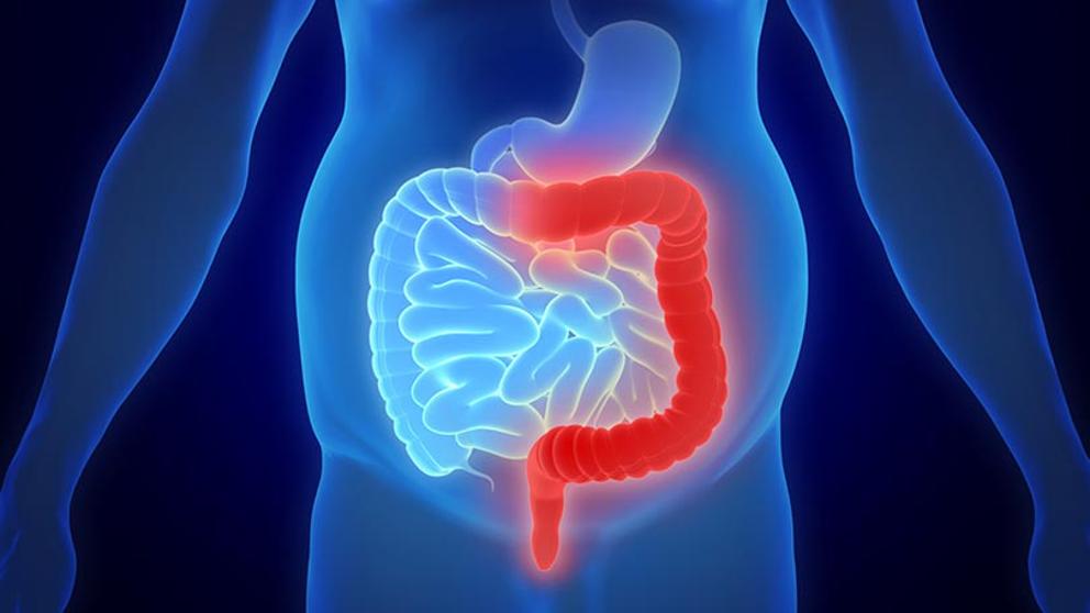 La colitis por uso de antibióticos Consulta Europea